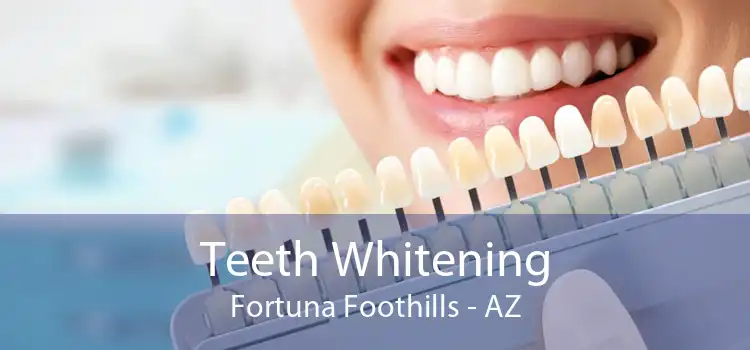 Teeth Whitening Fortuna Foothills - AZ