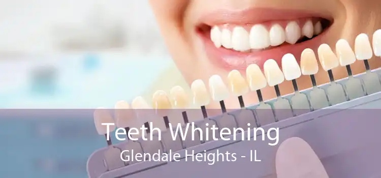 Teeth Whitening Glendale Heights - IL