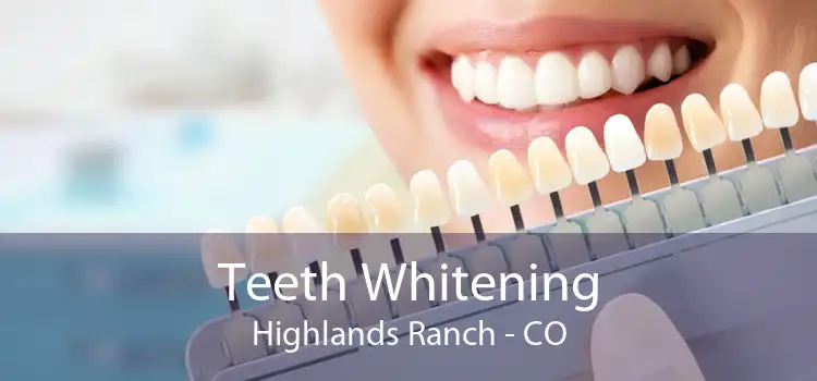 Teeth Whitening Highlands Ranch - CO
