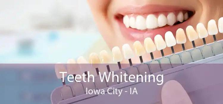 Teeth Whitening Iowa City - IA