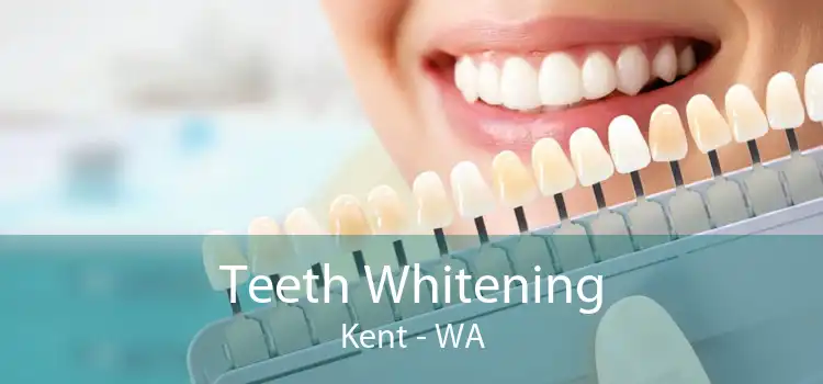 Teeth Whitening Kent - WA