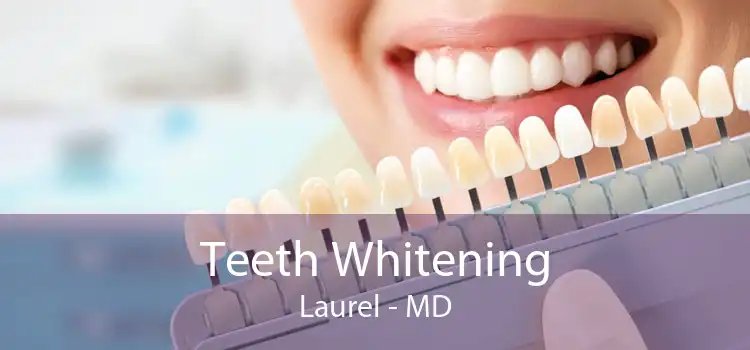 Teeth Whitening Laurel - MD