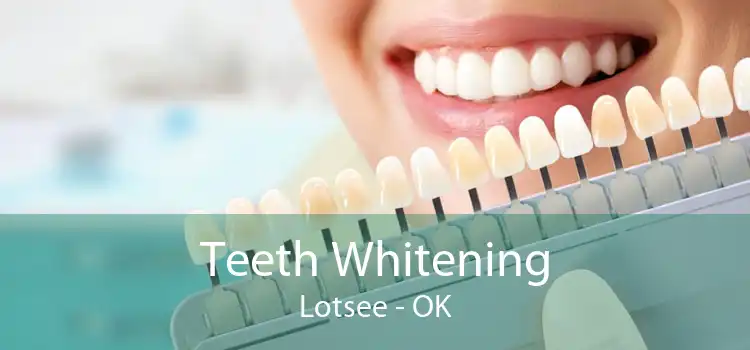 Teeth Whitening Lotsee - OK