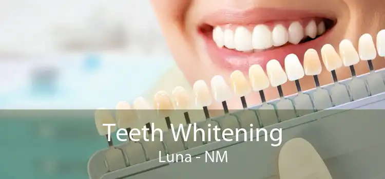 Teeth Whitening Luna - NM