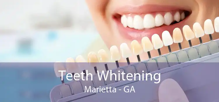 Teeth Whitening Marietta - GA