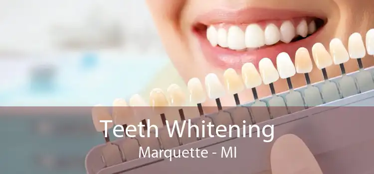 Teeth Whitening Marquette - MI