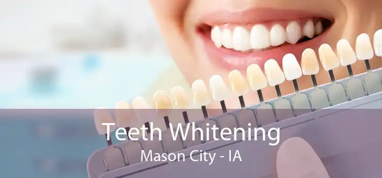 Teeth Whitening Mason City - IA
