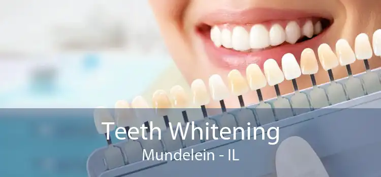 Teeth Whitening Mundelein - IL