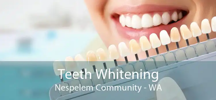 Teeth Whitening Nespelem Community - WA