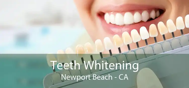 Teeth Whitening Newport Beach - CA
