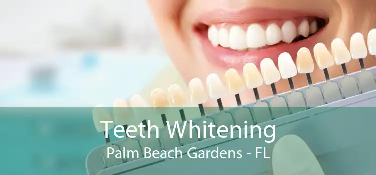 Teeth Whitening Palm Beach Gardens - FL