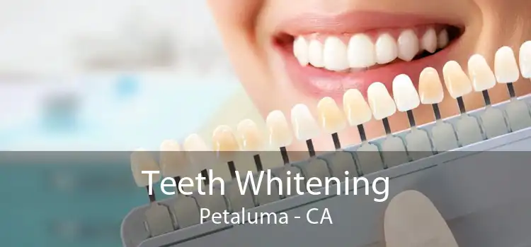 Teeth Whitening Petaluma - CA