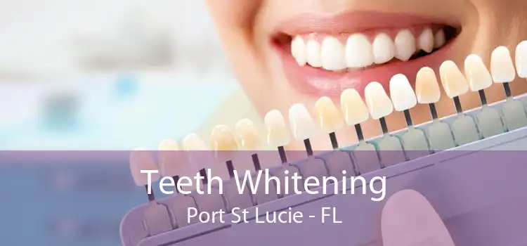 Teeth Whitening Port St Lucie - FL
