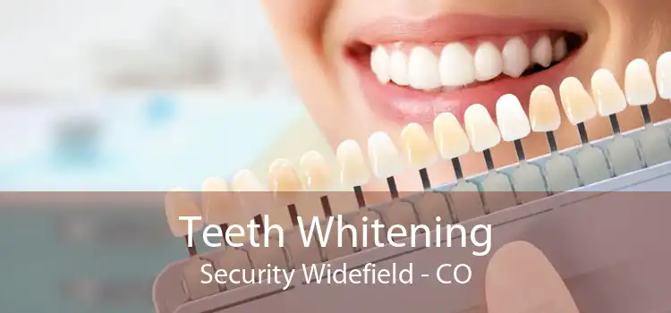 Teeth Whitening Security Widefield - CO