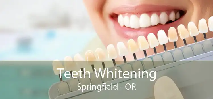 Teeth Whitening Springfield - OR