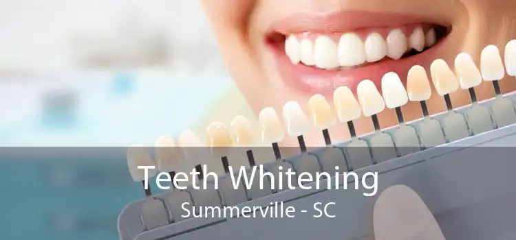 Teeth Whitening Summerville - SC
