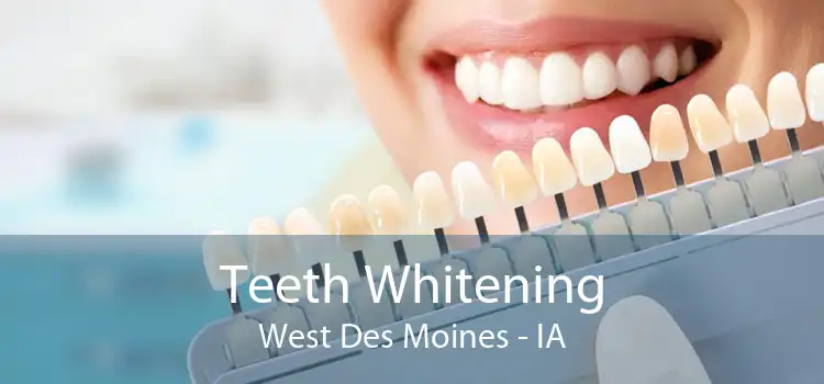 Teeth Whitening West Des Moines - IA