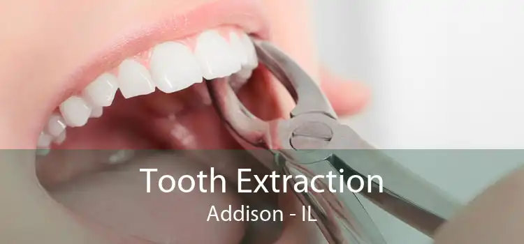 Tooth Extraction Addison - IL
