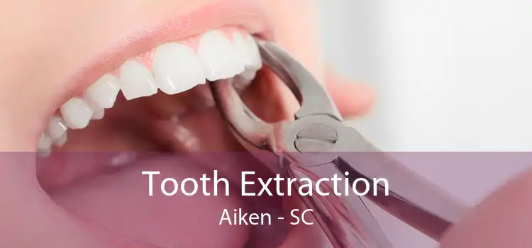 Tooth Extraction Aiken - SC