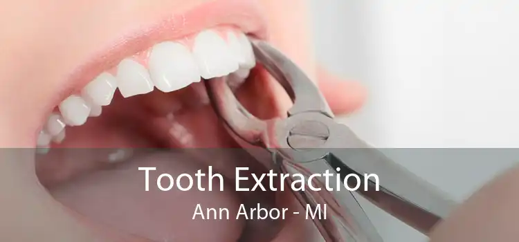 Tooth Extraction Ann Arbor - MI