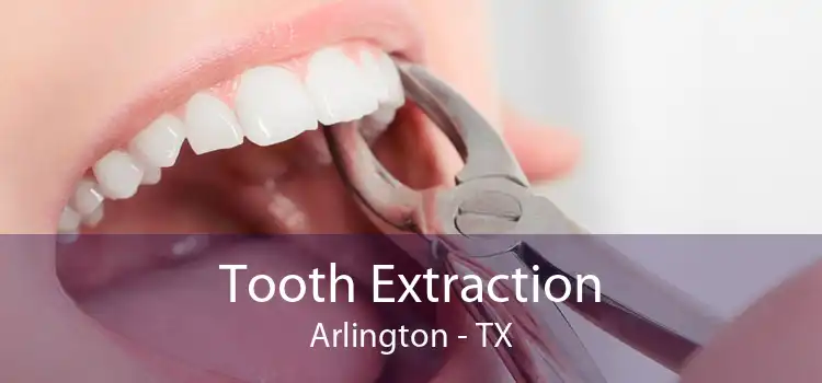 Tooth Extraction Arlington - TX