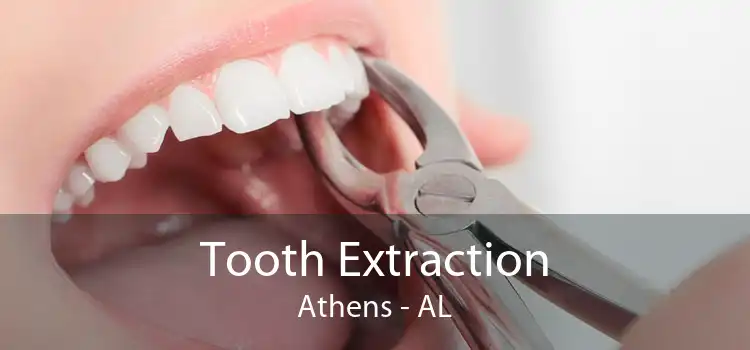 Tooth Extraction Athens - AL