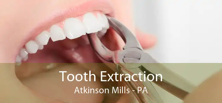 Tooth Extraction Atkinson Mills - PA