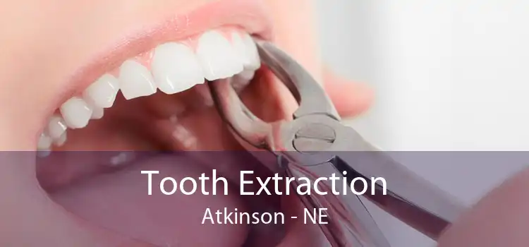 Tooth Extraction Atkinson - NE