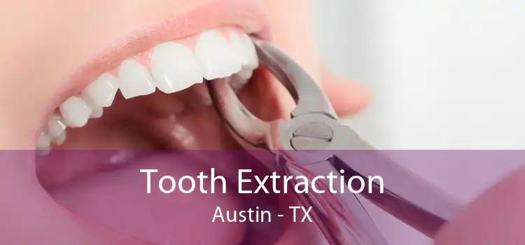 Tooth Extraction Austin - TX