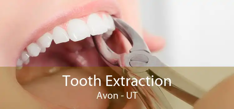 Tooth Extraction Avon - UT