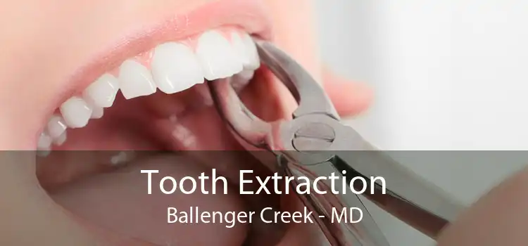 Tooth Extraction Ballenger Creek - MD