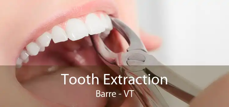Tooth Extraction Barre - VT
