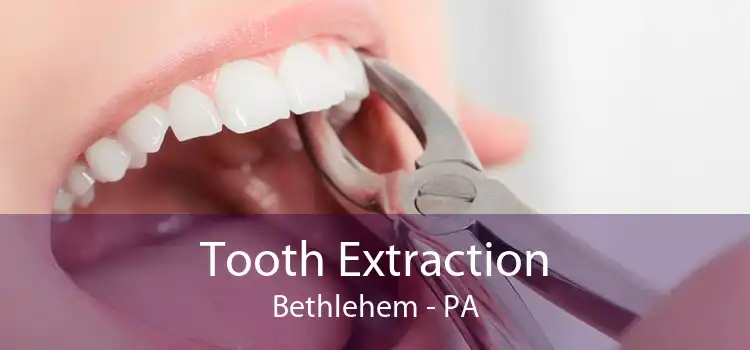 Tooth Extraction Bethlehem - PA