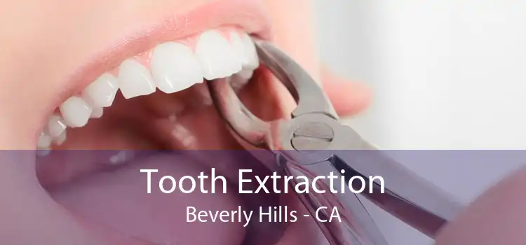 Tooth Extraction Beverly Hills - CA
