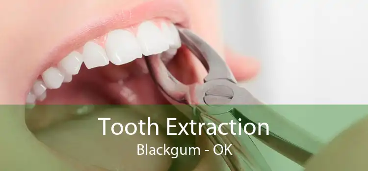 Tooth Extraction Blackgum - OK