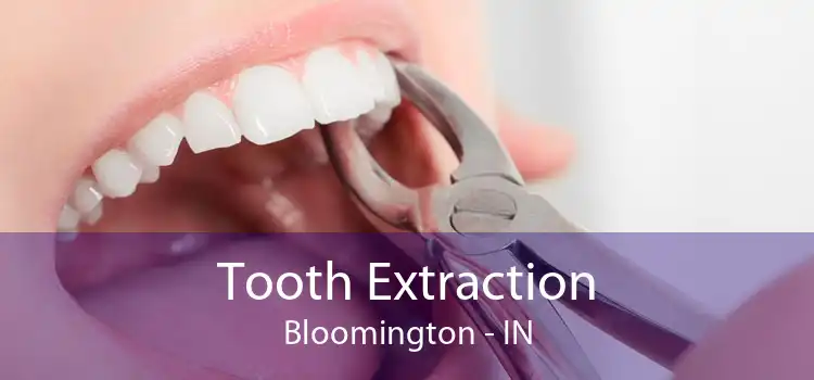 Tooth Extraction Bloomington - IN