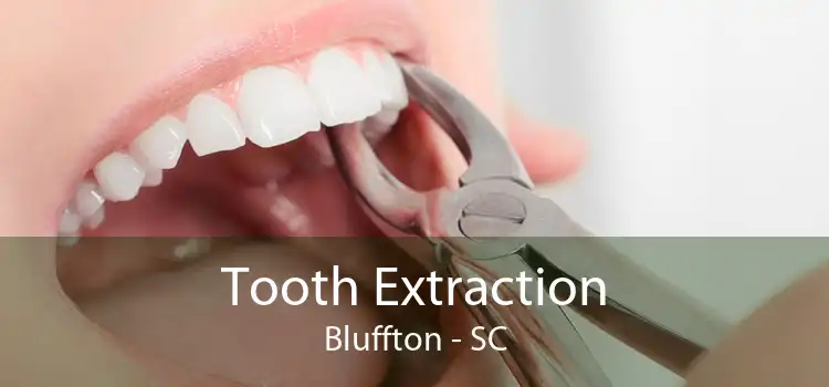 Tooth Extraction Bluffton - SC