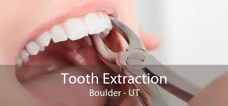 Tooth Extraction Boulder - UT