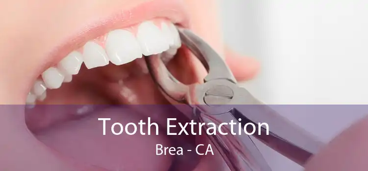 Tooth Extraction Brea - CA