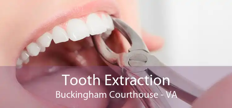 Tooth Extraction Buckingham Courthouse - VA