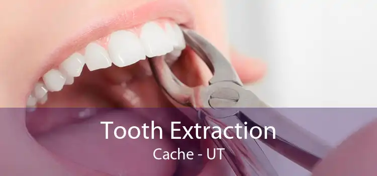 Tooth Extraction Cache - UT