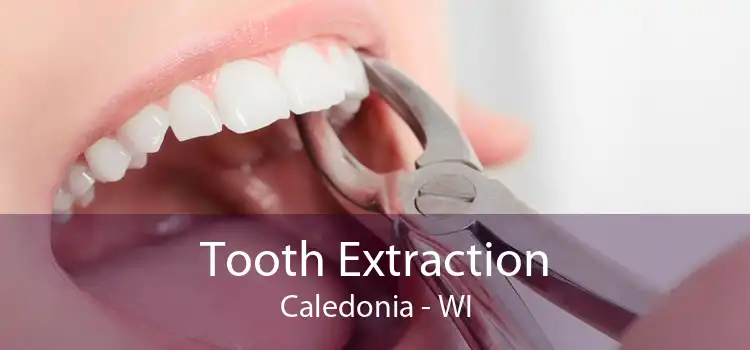 Tooth Extraction Caledonia - WI