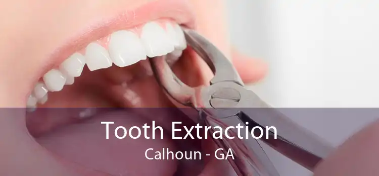 Tooth Extraction Calhoun - GA