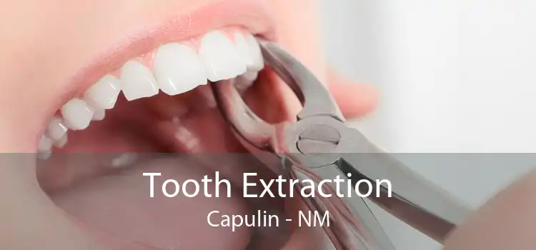 Tooth Extraction Capulin - NM