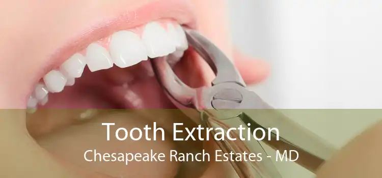 Tooth Extraction Chesapeake Ranch Estates - MD