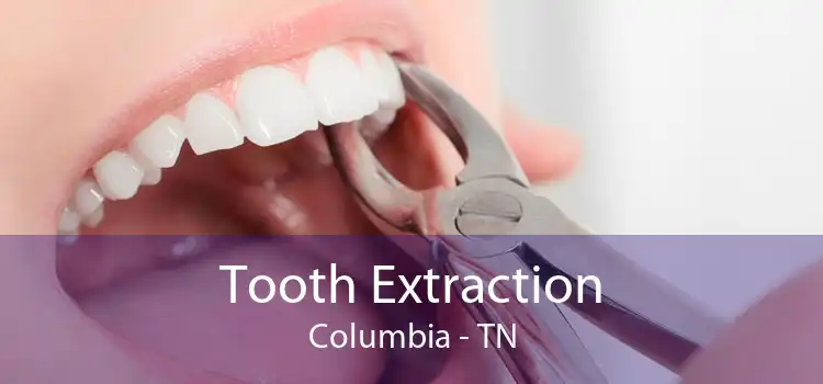 Tooth Extraction Columbia - TN