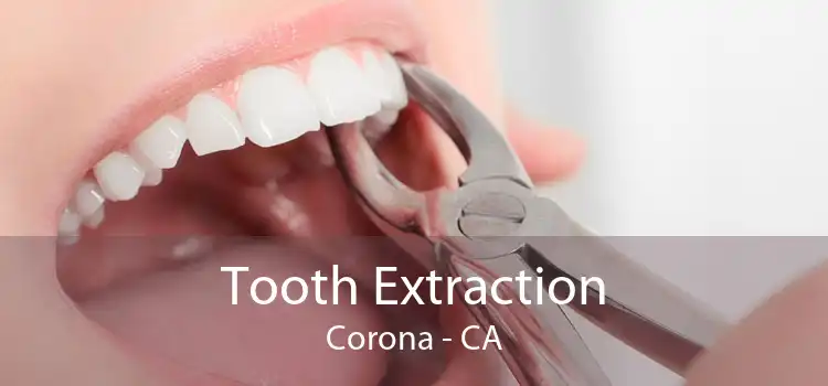 Tooth Extraction Corona - CA