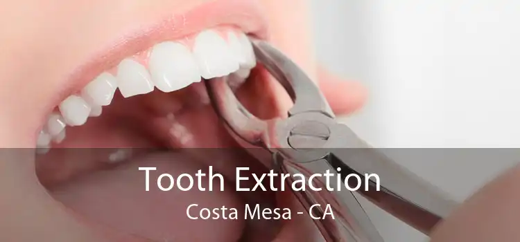 Tooth Extraction Costa Mesa - CA