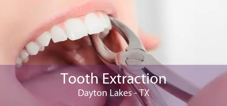 Tooth Extraction Dayton Lakes - TX