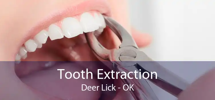 Tooth Extraction Deer Lick - OK